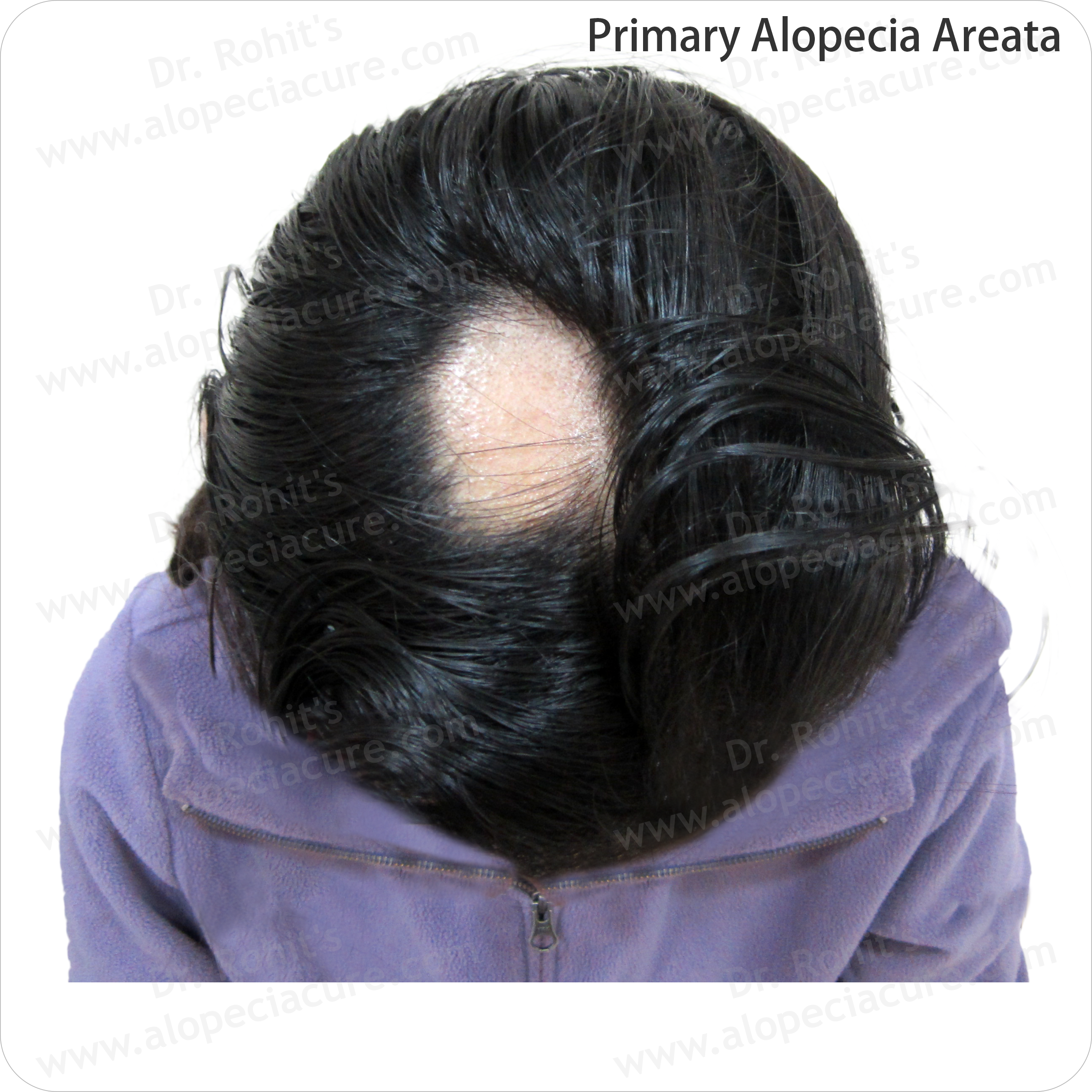 Clinical Hair Treatment